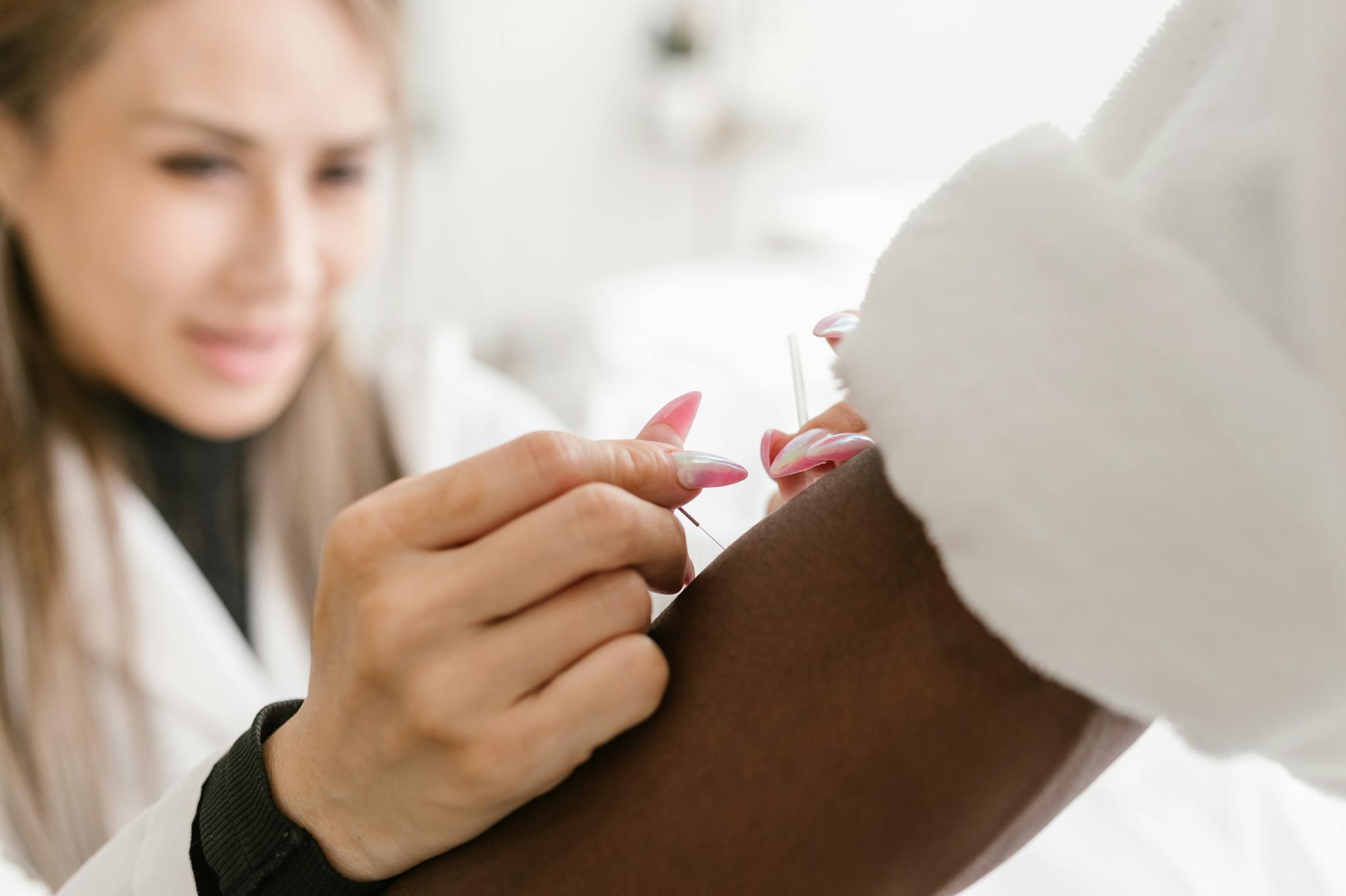 Close-up of a therapist performing acupuncture on a client's arm, promoting holistic health and wellness.